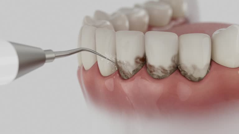 Trusted Root Canal Treatment service in Cheyenne, WY - Dentist Open Now